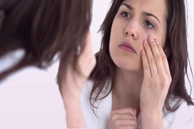 आंखों के आस-पास होने वाला सोरायसिस